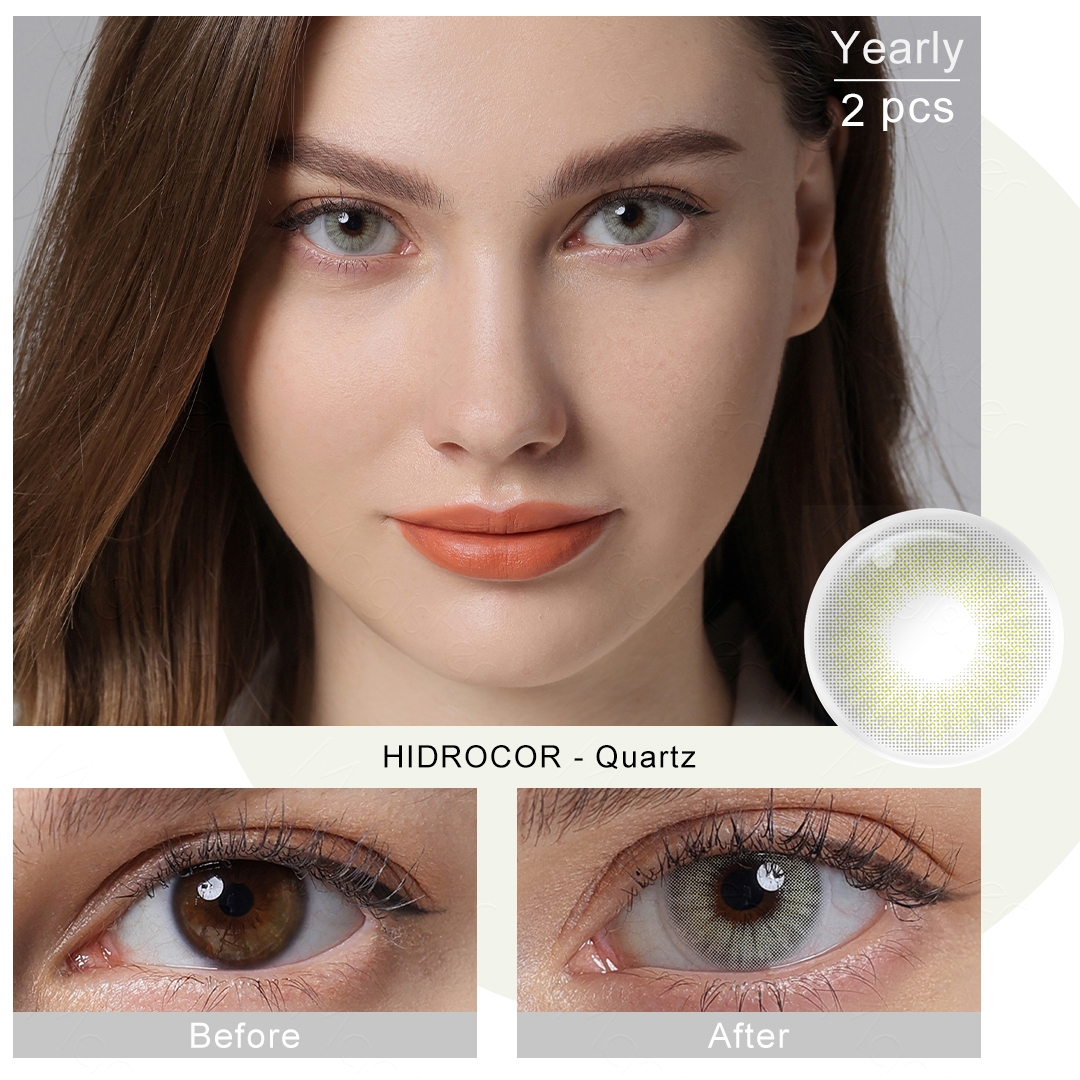 Contact Lens Feature Overview